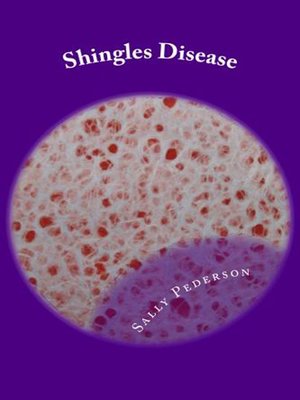 cover image of Shingles Disease